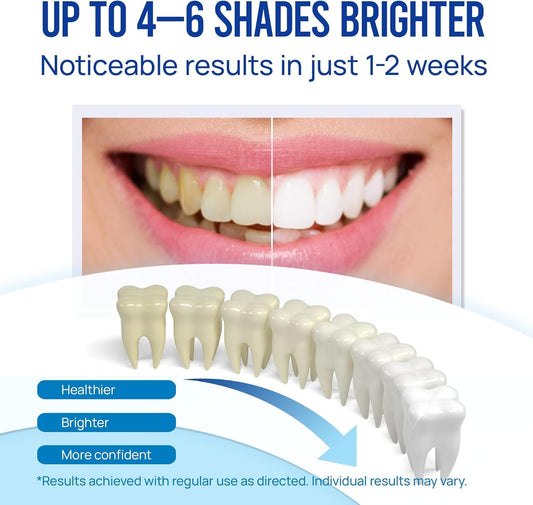 VieBeauti Teeth Whitening Pen (3 Pcs), 30+ Uses, Effective, Painless, No Sensitivity, Travel-Friendly, Easy to Use, Beautiful White Smile, Mint Flavor